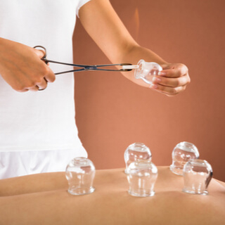 Dry Cupping Therapy